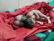 Conmoción en la India por el nacimiento de una beba ¨con tres cabezas¨